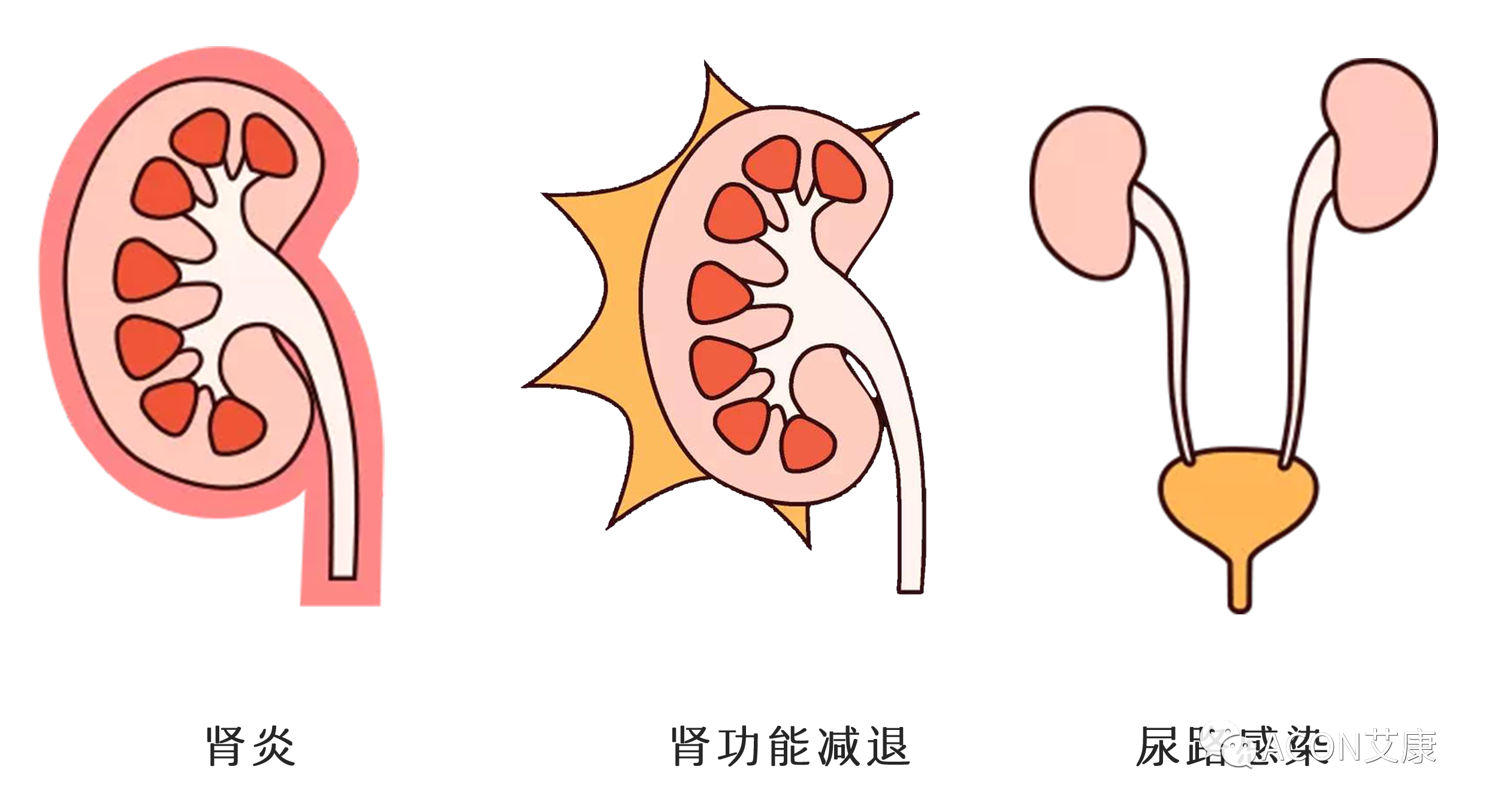 排尿黃、異味大，可能是身體在報警！