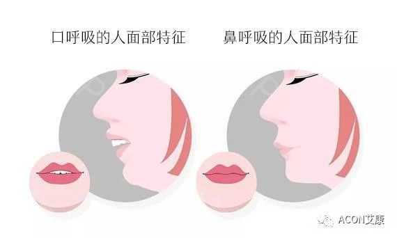 過敏性鼻炎會讓孩子變傻？！家長該如何應對